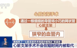 心脏支架手术将逐步被淘汰？真相来了